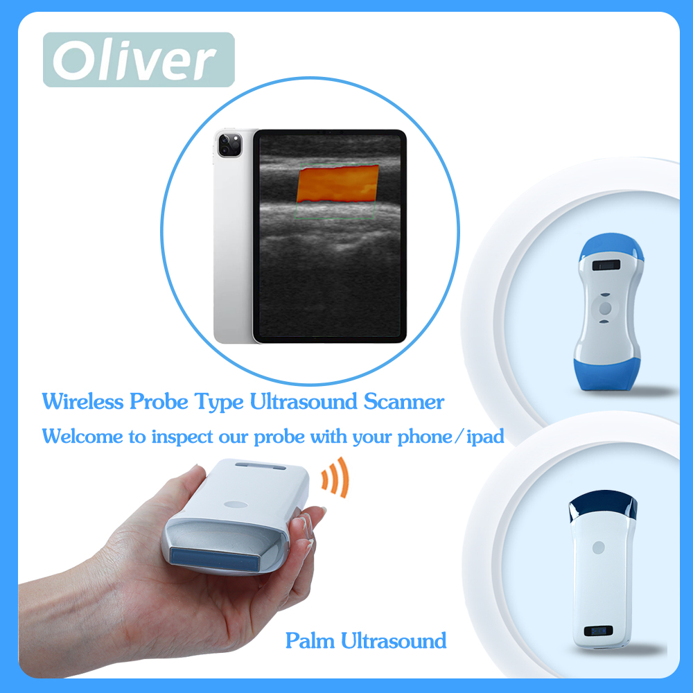 Portable Ultrasound Machine - USG Wireless Ultrasound Probe scanner portable