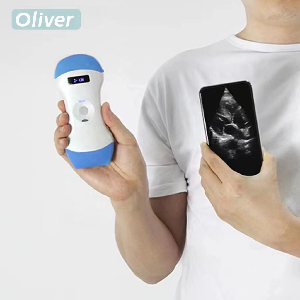 USG Wireless Ultrasound Probe  – обзор и цена Portable Ultrasound Machine